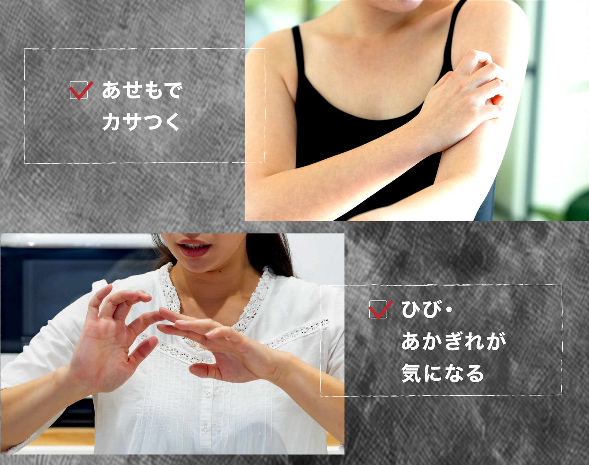 あせもでカサつく　