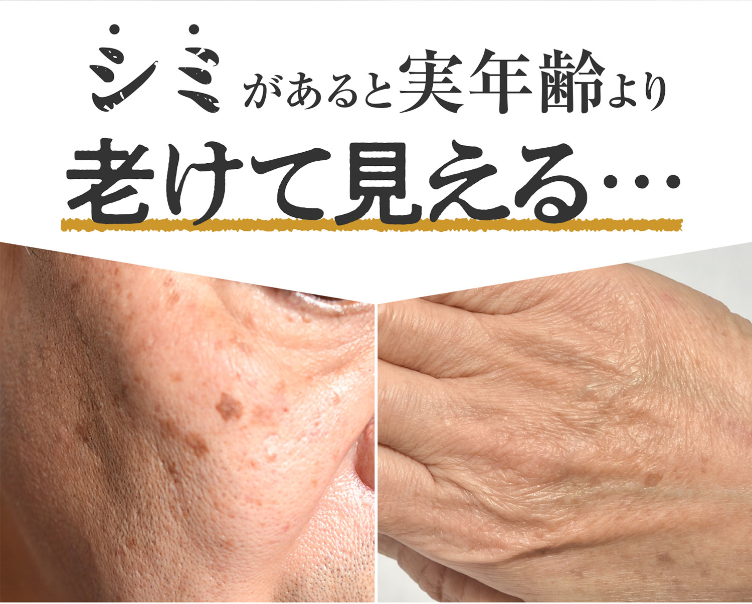 シミがあると実年齢より老けて見える