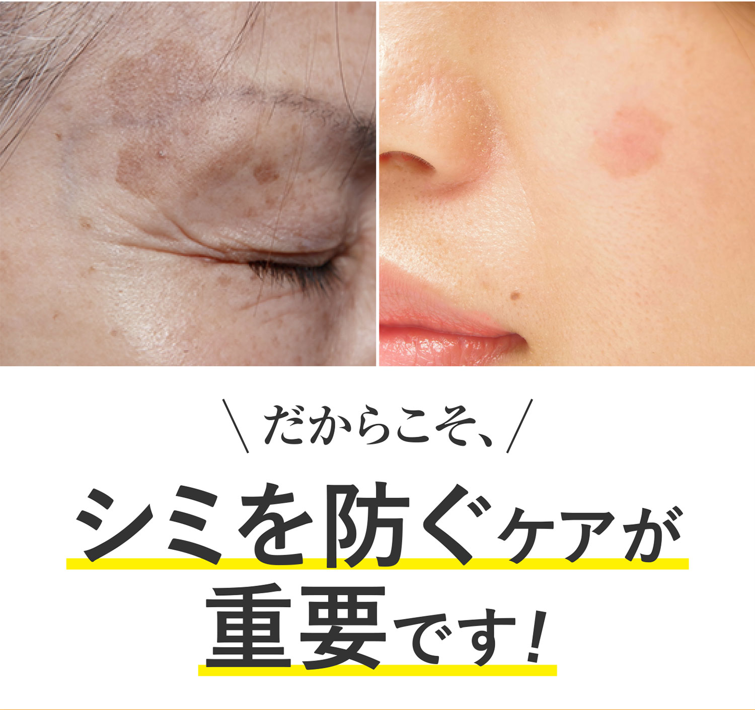 だからこそ シミを防ぐケアが必要です